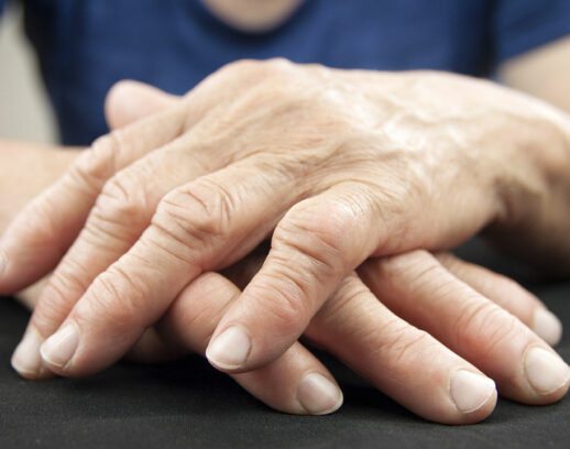 6 Ways to Manage the Symptoms of Arthritis