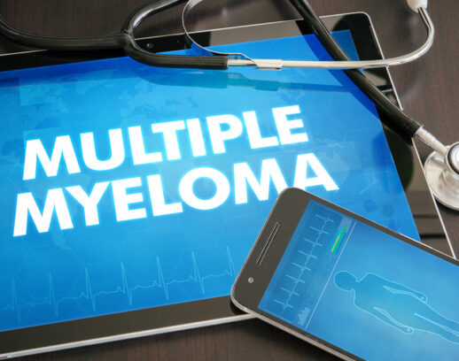 Causes, Risk Factors, and Prevention of Multiple Myeloma
