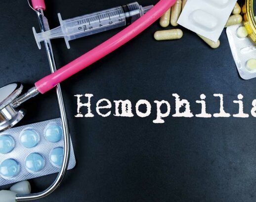 Causes, Symptoms, and Complications of Hemophilia