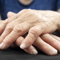 Treatment options and medications for managing rheumatoid arthritis