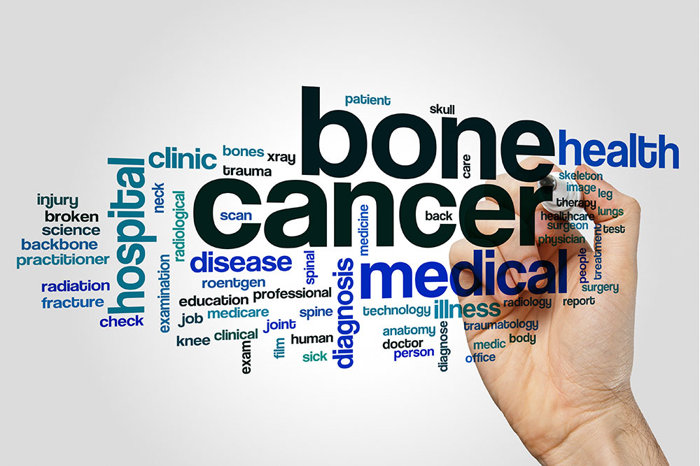 6 warning signs of bone cancer that demand therapy