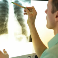 7 signs that may indicate lung disease