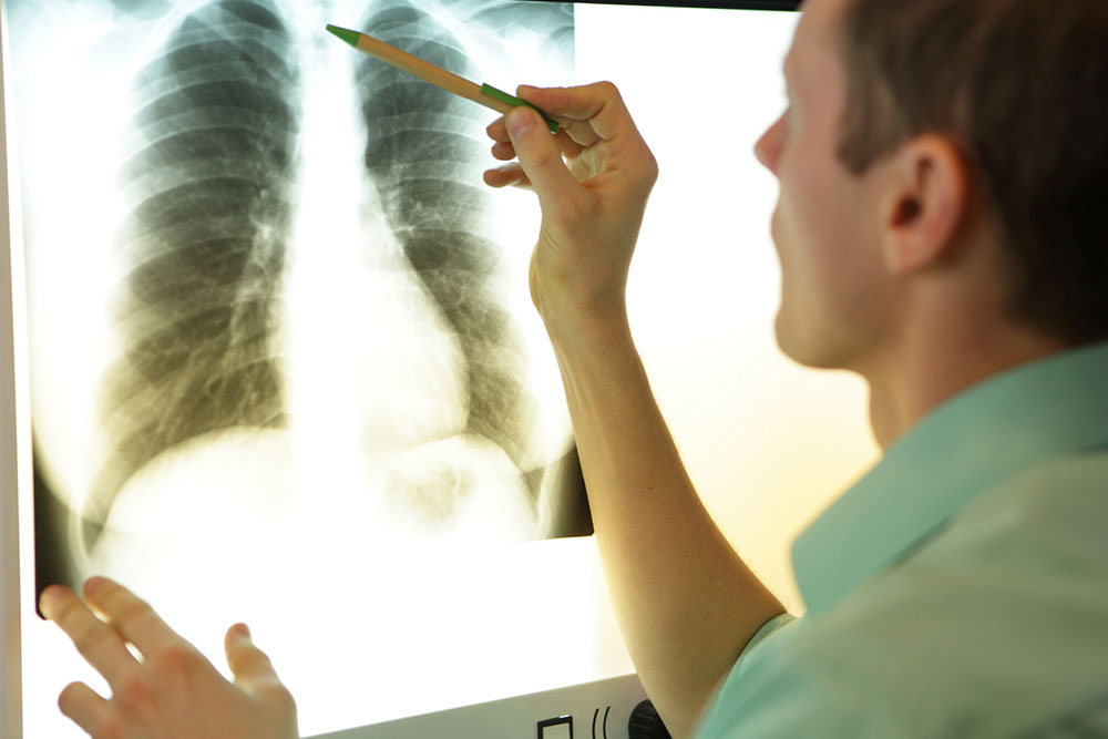 7 signs that may indicate lung disease