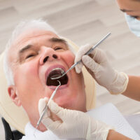 9 common mistakes to avoid with dental implants